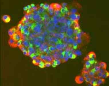 stem_cell1.jpg